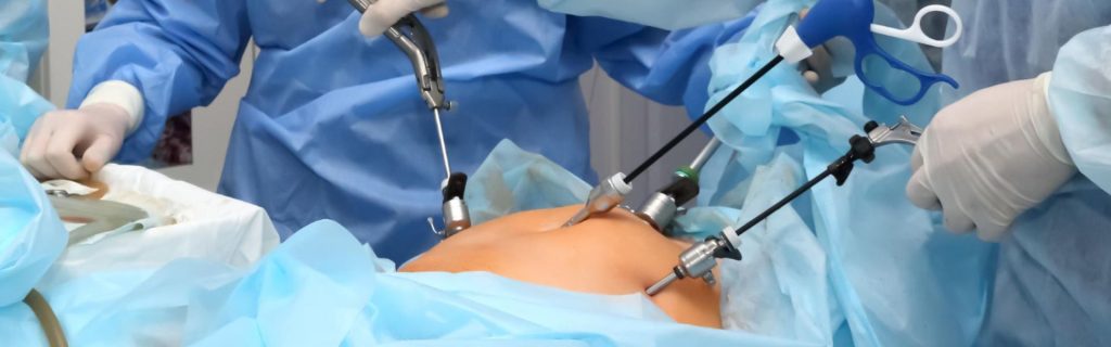 Cirugía Bariátrica - CleverSalud