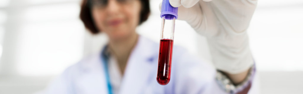 Gloved lab technician holds a blood-filled test tube with a purple cap toward the camera.