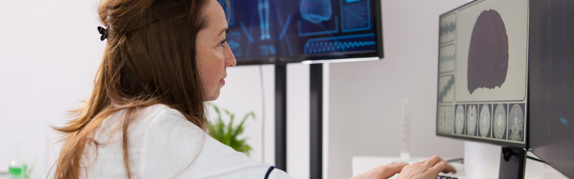 Female doctor with long brown hair studies brain MRI scans on multi-panel monitors in a clinical setting