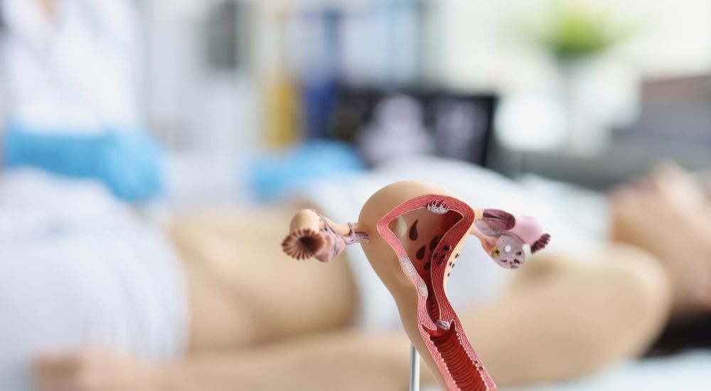 Importancia del control ginecológico en las diferentes etapas de la vida de la mujer