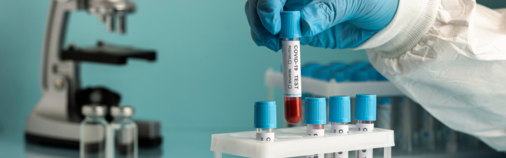 Gloved hand places a COVID-19 test tube into a rack, with other vials and a microscope in the lab.