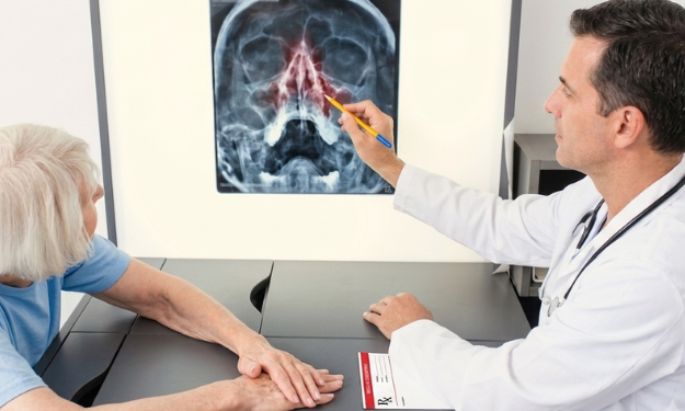 Doctor points to a head imaging scan on a lightbox as an elderly patient sits at the examination table.