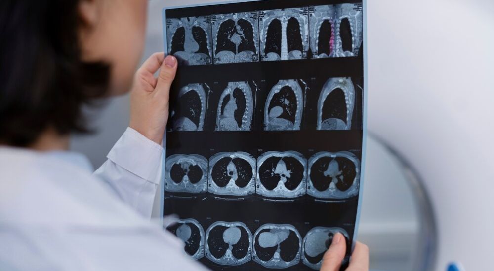 Resonancia Nuclear Magnética