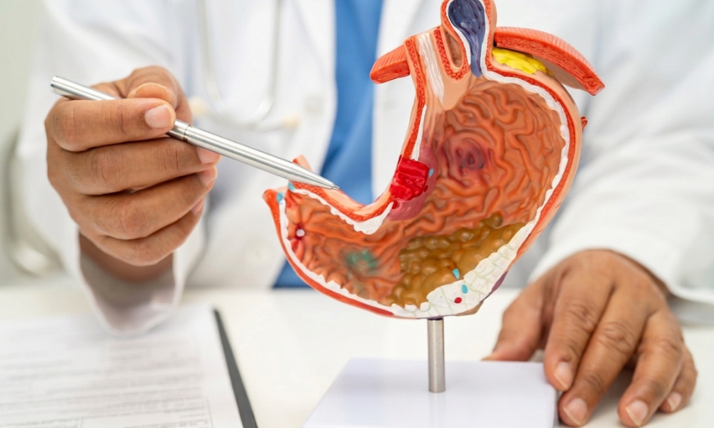Medical professional explains stomach anatomy using a 3D cutaway stomach model on a stand, pointing with a silver pen.