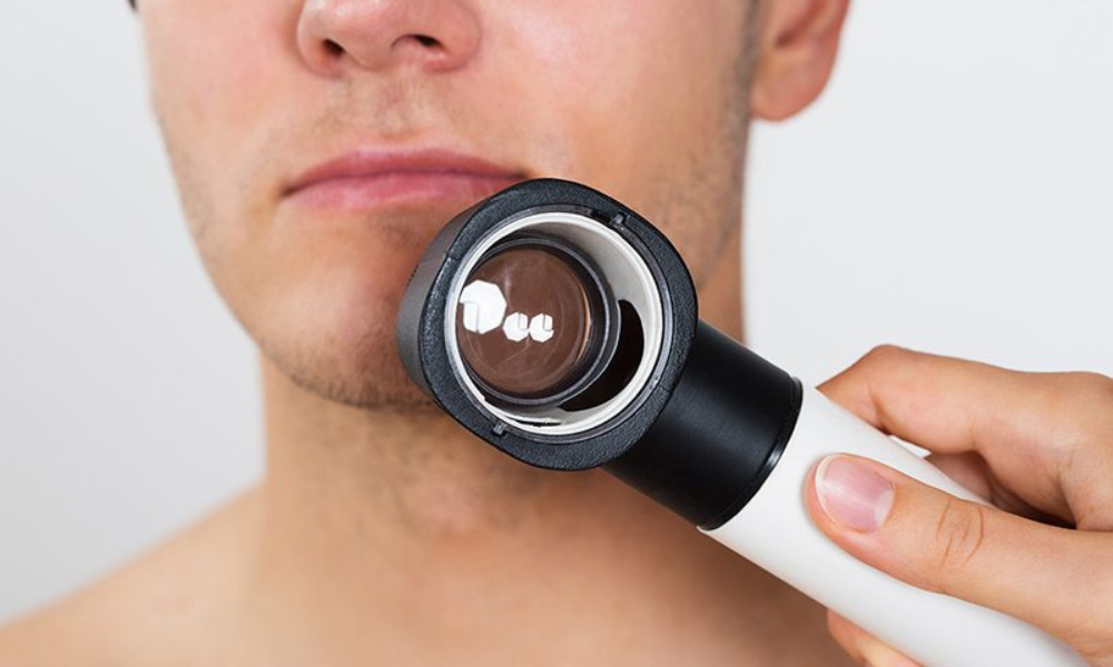 Close-up of a man having a dermatoscope placed on his neck to examine skin.